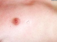 085 Amanda 25 April 2007