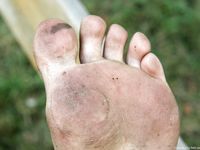 Feet - Alexandra - 2010-08-08 Hot asphalt and bare feet