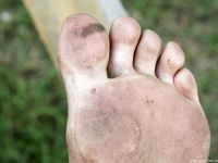 Feet - Alexandra - 2010-08-08 Hot asphalt and bare feet