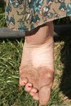 Feet - Alexandra C - 2012-03-05 Hot summer feet
