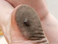 Feet - Anna A - 2011-01-02 Public barefoot walk