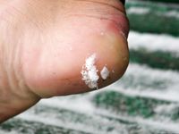 Feet - Anna B - 2011-04-28 Barefoot in snowstorm