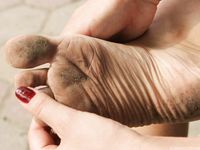 Feet - Anna G - 2012-11-11 Barefoot girl in a short skirt