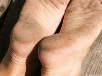 Feet - Anna G - 2012-11-11 Barefoot girl in a short skirt