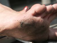 Feet - Daria C - 2012-01-22 Girl in zebra dress