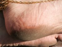 Feet - Daria C - 2012-01-22 Girl in zebra dress