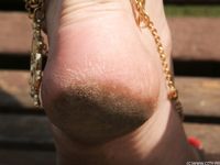 Feet - Daria C - 2012-01-22 Girl in zebra dress