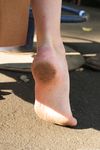 Feet - Galina - 2014-05-12 Cold autumn weather