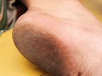 Feet - Gulnara A - 2010-11-01 Dirty feet in public