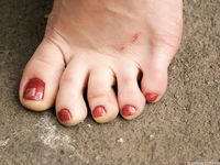 Feet - Inna A - 2011-05-27 Uncomfortable shoes