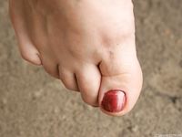 Feet - Inna A - 2011-05-27 Uncomfortable shoes