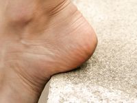 Feet - Inna A - 2011-05-27 Uncomfortable shoes