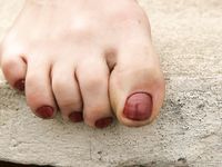 Feet - Inna A - 2011-05-27 Uncomfortable shoes