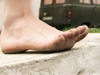 Feet - Inna A - 2011-05-27 Uncomfortable shoes