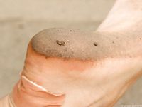 Feet - Inna A - 2011-05-27 Uncomfortable shoes