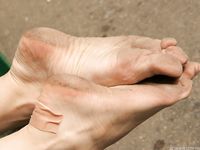 Feet - Inna A - 2011-05-27 Uncomfortable shoes