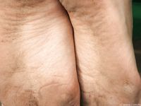 Feet - Inna A - 2011-05-27 Uncomfortable shoes