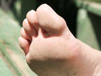 Feet - Ira A - 2007-11-26 Sunlit bare feet