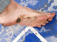 Feet - Ira B + Nata A - 2009-02-26 Autumn barefoot travel