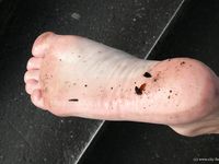 Feet - Ira B + Nata A - 2009-02-26 Autumn barefoot travel