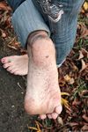 Feet - Ira B + Nata A - 2009-02-26 Autumn barefoot travel