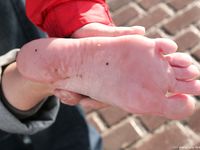 Feet - Ira B - 2008-02-26 A romantic winter walk