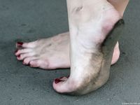 Feet - Ira C - 2011-01-27 Rest in a park