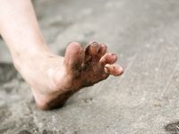 Feet - Ira C - 2011-01-27 Rest in a park