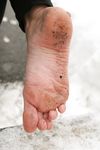 Feet - Ira D - 2013-07-29 The first winter barefoot experience