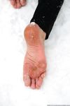 Feet - Irina A - 2015-08-27 Barefoot in the winter city