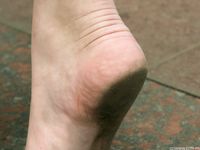 Feet - Jenya A - 2012-03-19 Cool autumn morning