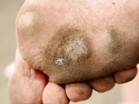 Feet - Julia D - 2011-08-04 Gloomy day