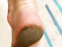 Feet - Julia D - 2011-08-04 Gloomy day