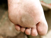 Feet - Julia D - 2011-08-04 Gloomy day