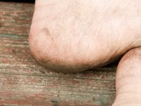 Feet - Julia D - 2011-08-04 Gloomy day