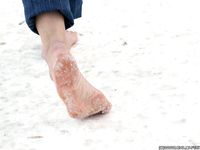 Feet - Kapa - 2011-07-02 Tough feet in snow