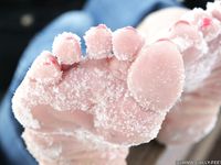 Feet - Kapa - 2011-07-02 Tough feet in snow