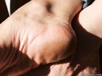 Feet - Kapa - 2011-07-02 Tough feet in snow