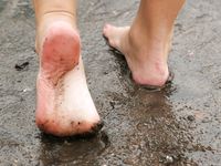 Feet - Katya B - 2010-09-13 Cold rain and wind