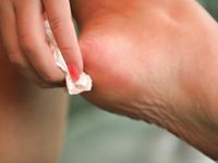 Feet - Katya B - 2010-09-13 Cold rain and wind