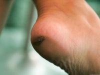 Feet - Katya B - 2010-09-13 Cold rain and wind