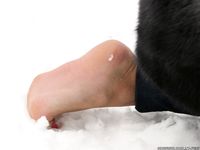 Feet - Kristina - 2012-04-05 Spring thaw