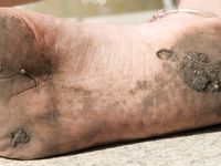 Feet - Ksenia B - 2011-07-02 Different barefoot experience