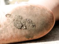 Feet - Ksenia B - 2011-07-02 Different barefoot experience