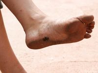 Feet - Lena D + Dina - 2008-08-04 Barefoot trip to Mytishi