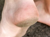 Feet - Lena D - 2009-03-31 Barefoot in metro & sexy soles in the city