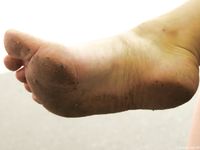 Feet - Lena F - 2010-06-09 Feet with high arches