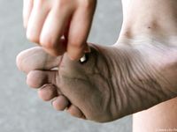 Feet - Lena F - 2010-06-09 Feet with high arches