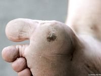 Feet - Lena F - 2010-06-09 Feet with high arches