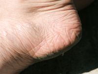 Feet - Lena G - 2011-10-31 Beauty with dirty soles